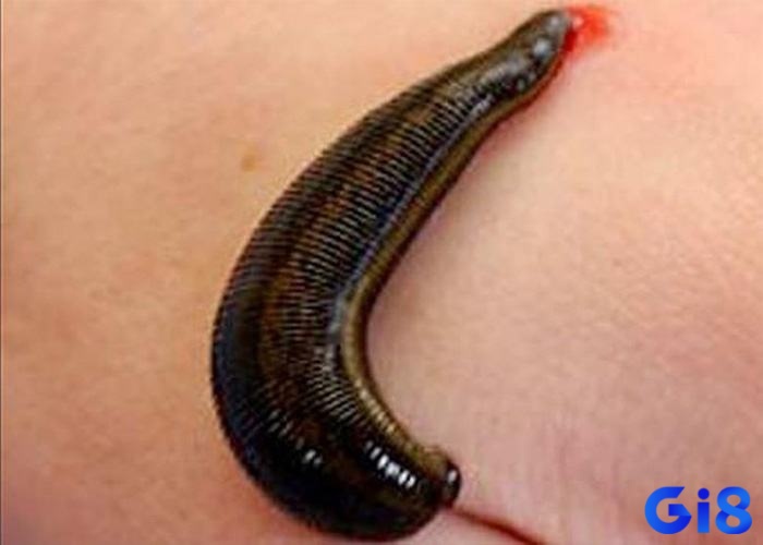 Giải mã giấc mơ thấy đỉa bám vào chân và hút máu là biểu thị cho việc bạn đang kiệt sức