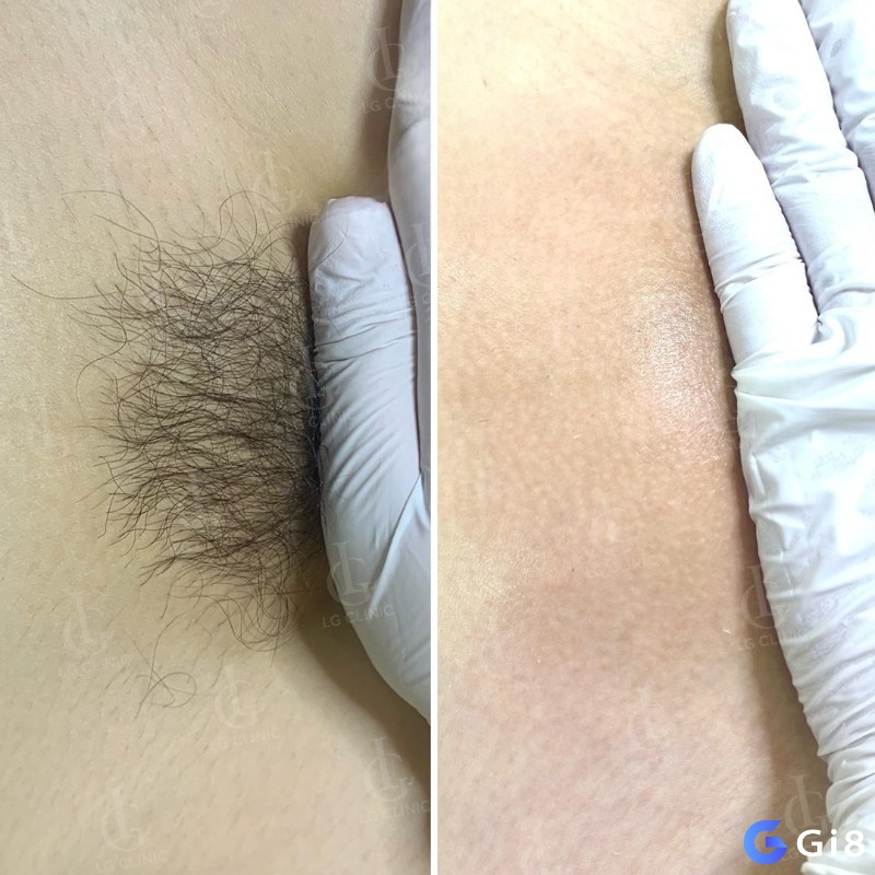 Mơ thấy lông vùng kín đánh con gì mang lại cho bạn những con số may mắn liên quan khác nhau