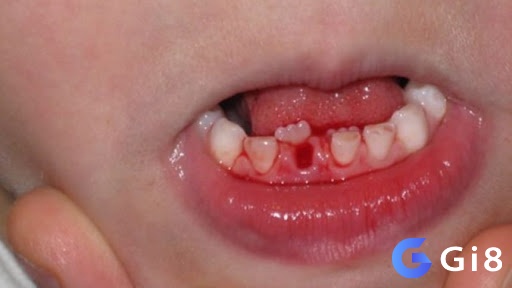 Giấc mơ thấy rụng răng chảy máu thể hiện cho những áp lực trong cuộc sống của bạn